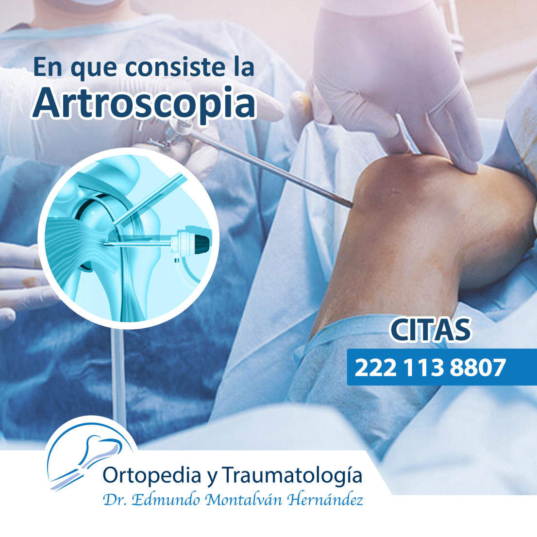 Procedimiento de Artroscopia