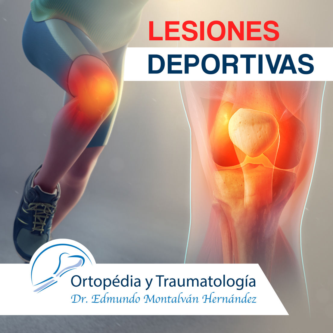 Tratamiento de Lesiones deportivas