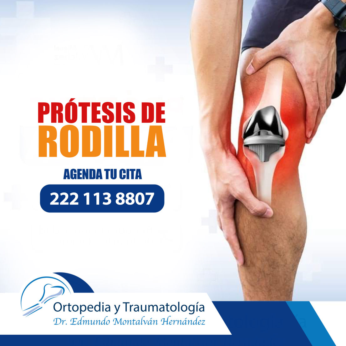 Prótesis de rodilla en Chilpancingo