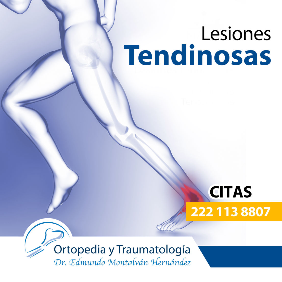 Lesiones tendinosas